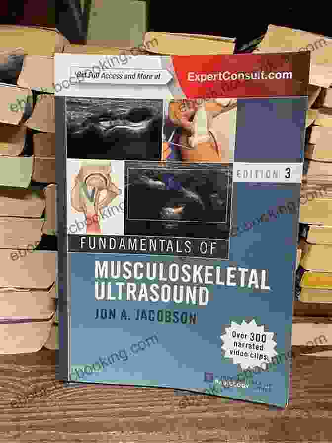 Musculoskeletal Ultrasound Image Fundamentals Of Musculoskeletal Ultrasound E (Fundamentals Of Radiology)