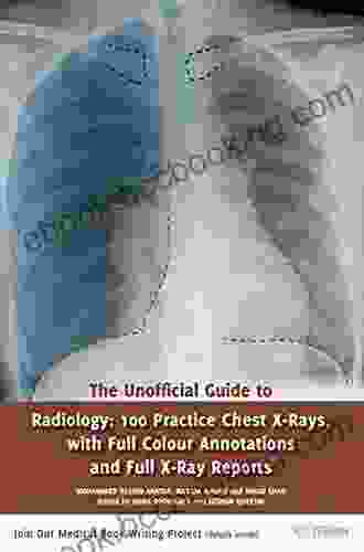The Unofficial Guide To Radiology: 100 Practice Chest X Rays With Full Colour Annotations And Full X Ray Reports (Unofficial Guides To Medicine)